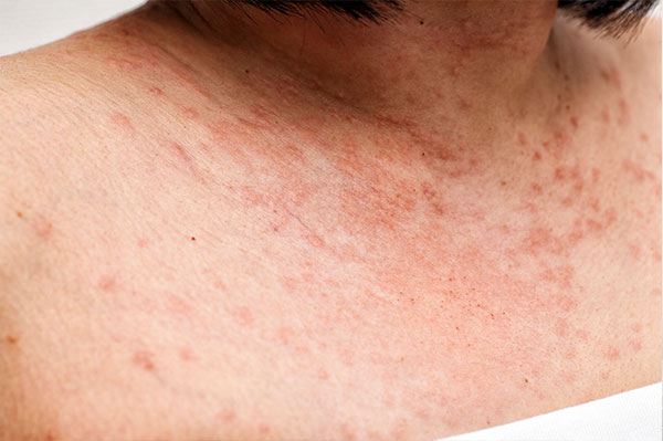 医師に連絡する