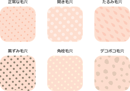 毛穴の開きの改善