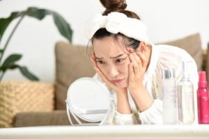 イソトレチノインとは?