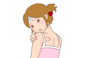 粉瘤（アテローム）についての日帰り手術